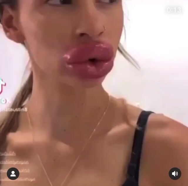 640px x 634px - Extreme fake lips